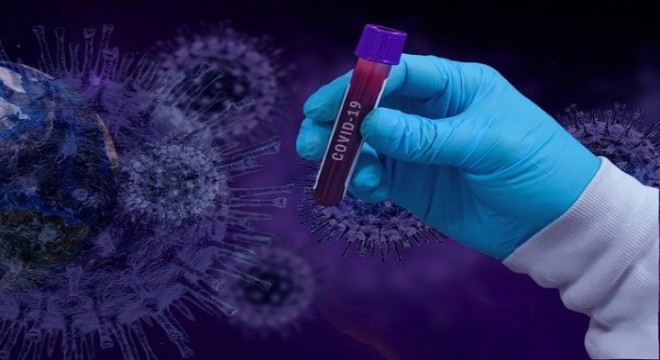 Koronavirüs salgınında ölenlerin sayısı 6 bin 730'a ulaştı